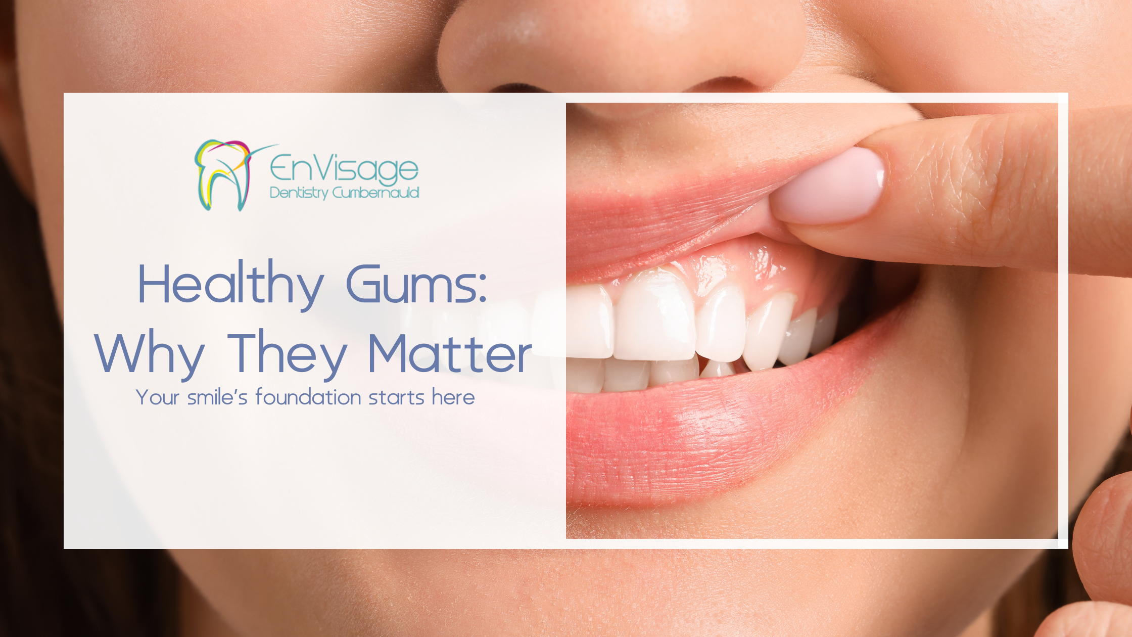 Healthy Gums: Why They Matter and How to Maintain Them