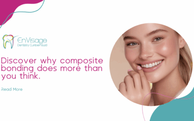 Why Composite Bonding Is More Than Just a Quick Fix 