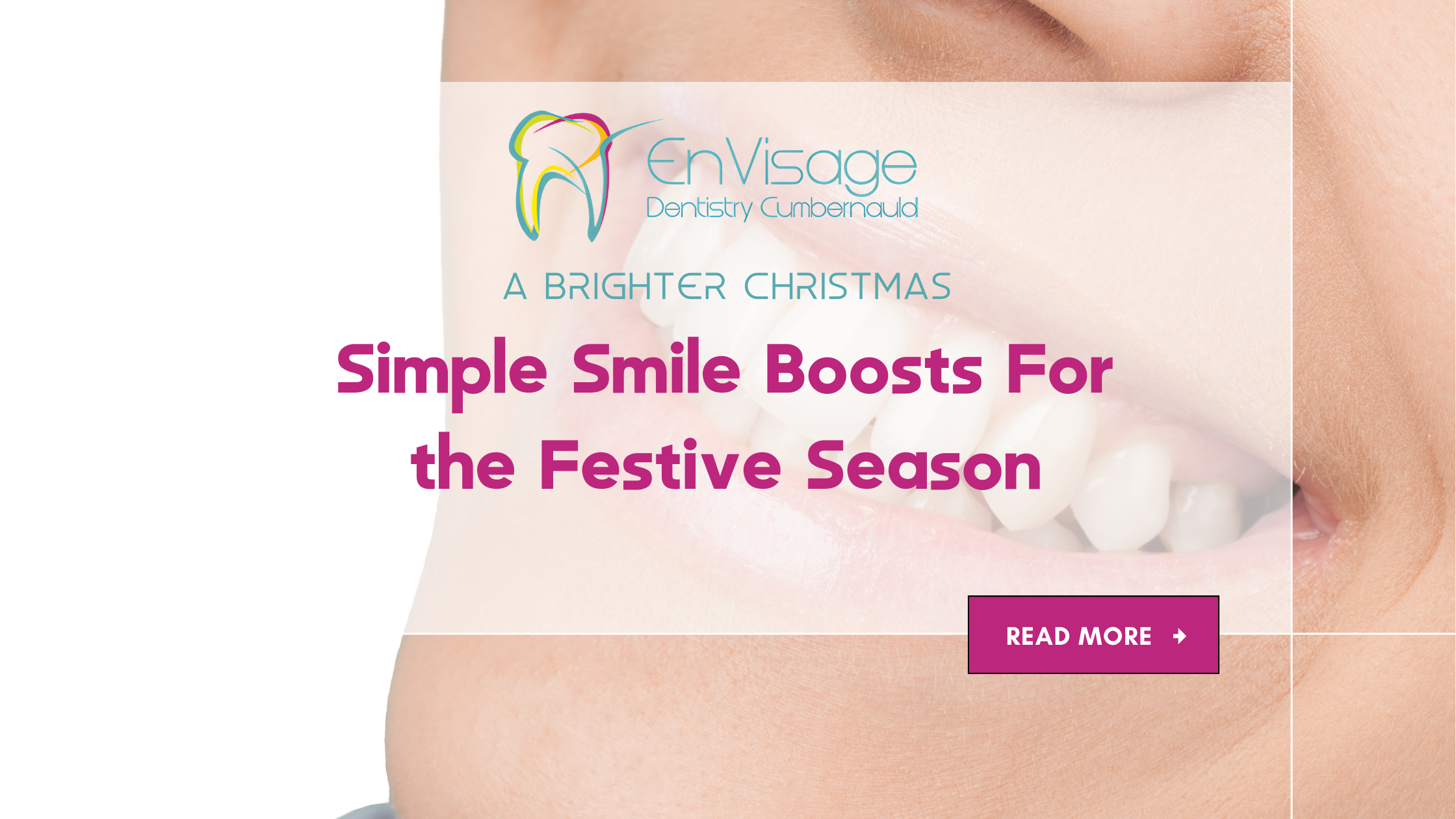 A Brighter Christmas: Simple Smile Boosts You Can Get for Holidays