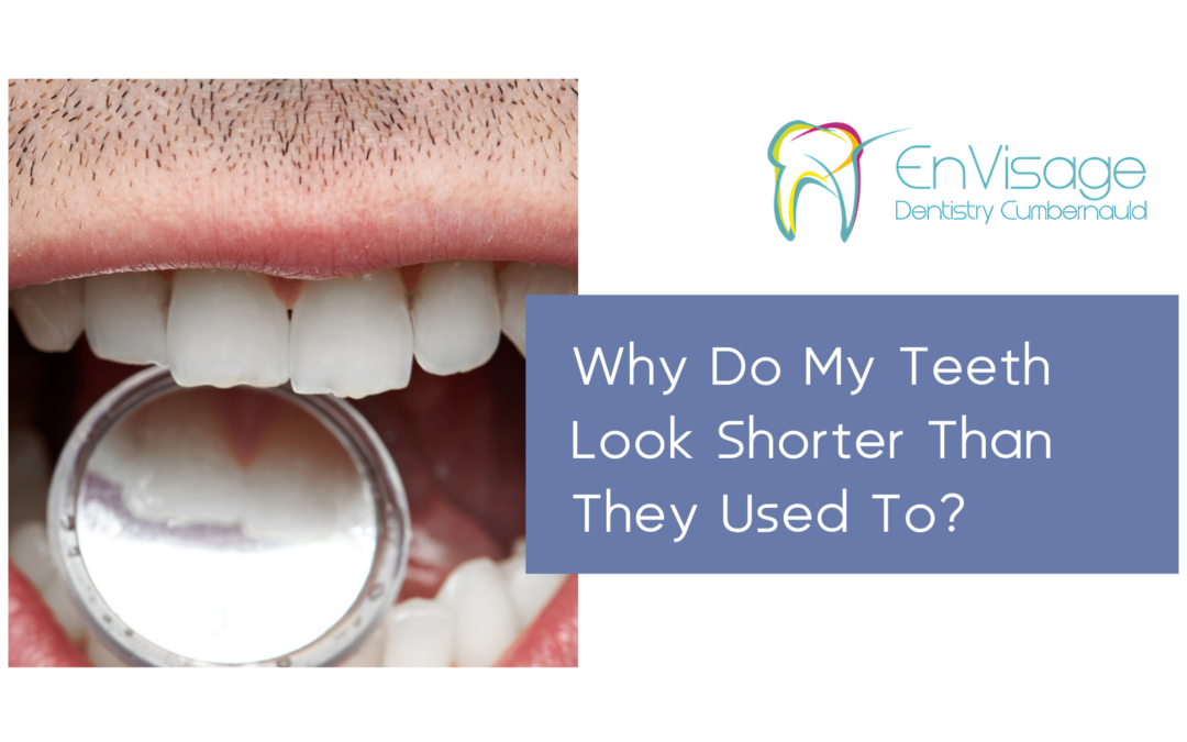 Why Do My Teeth Look Shorter Than They Used To?