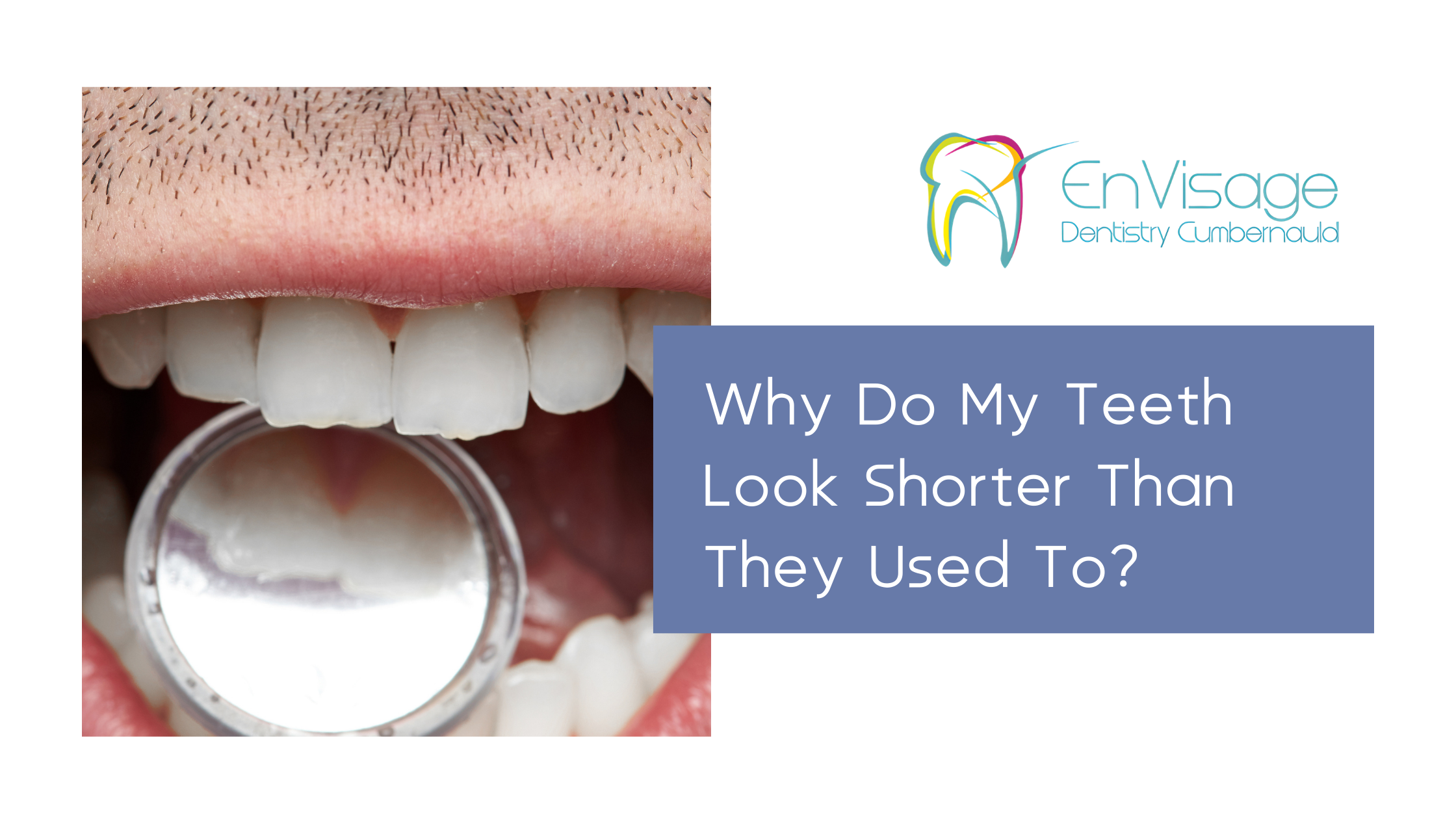 Why Do My Teeth Look Shorter Than They Used To? |