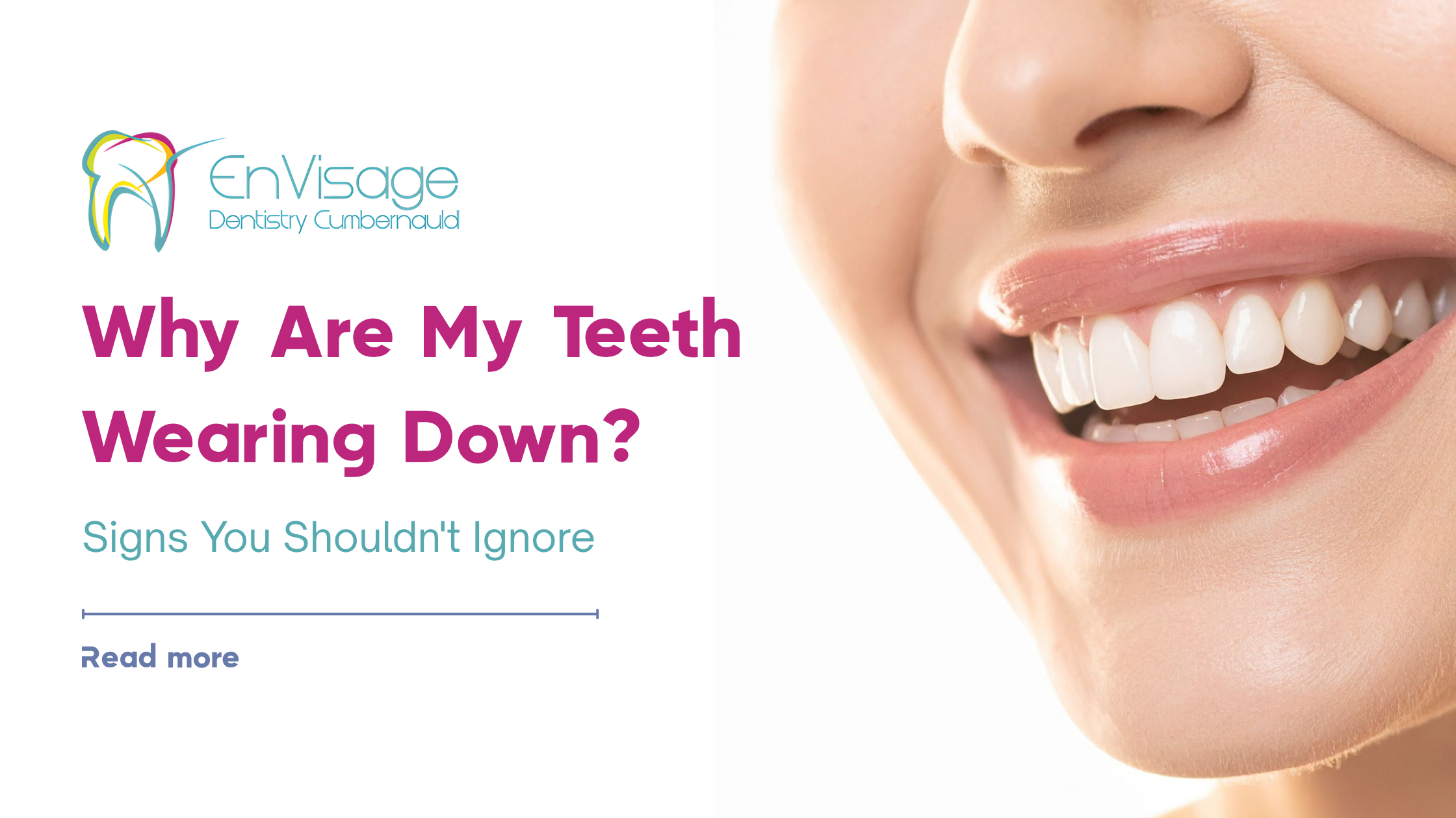 Why Are My Teeth Wearing Down? Signs You Shouldn't Ignore